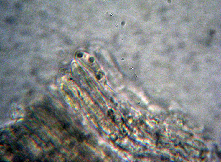 Forse � un ascomicete...(cfr. Lachnella sp.)